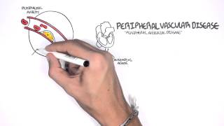 Cardiovascular Disease Overview [upl. by Frendel]