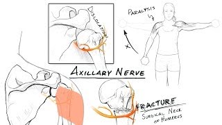 The Brachial Plexus II Animated Review HD [upl. by Kcirrez744]