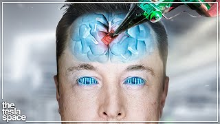 How Neuralink Will Cure Blindness [upl. by Rezeile]