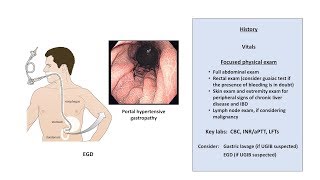 An Approach to GI Bleeding Melena Hematemesis Hematochezia [upl. by Tullus]