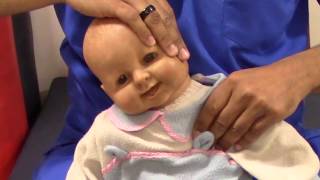 08 Congenital muscular torticollis Intervention Stretching [upl. by Sigismond610]