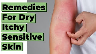 10 Home Remedies amp Treatments for Eczema and Dry Itchy and Sensitive Skin [upl. by Htennaj]