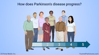 What is Parkinsons Dystonia [upl. by Roht]