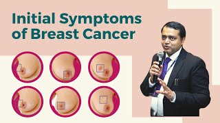 Symptoms of Breast Cancer amp methods to detect it early Hindi  Dr Rohan Khandelwal [upl. by Bergmans]