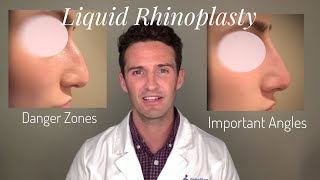 Liquid Rhinoplasty Everything you need to know [upl. by Ginny]