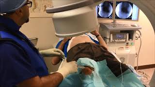 Genicular Nerve Ablation for knee pain [upl. by Verdi]