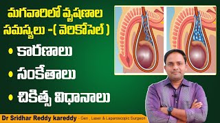 వెరికోస్ ఎగ్జిమా అంటే ఏమిటి  Causes and Treatment for Varicose Eczema  Dr Anand Hair And Skin [upl. by Gnilrac]