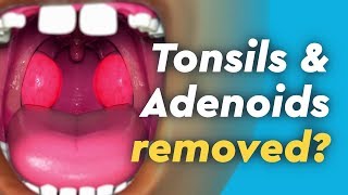 Tonsillectomy and adenoidectomy instruments  ENT [upl. by Drucill]