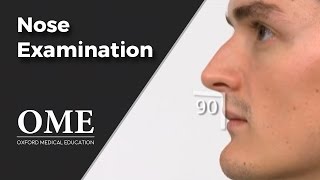 Nose Examination Inspection  ENT [upl. by Sitelc]