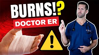 How to Treat a Second Degree Burn  Auburn Medical Group [upl. by Emmer694]