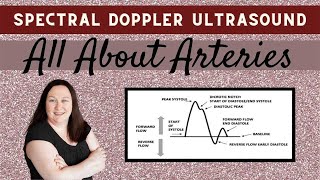 TAVI Transcatheter Aortic Valve Implantation [upl. by Aelgna582]