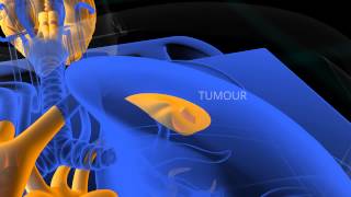 PET Scan animation [upl. by Lennej]