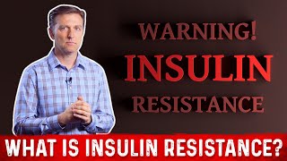 What Is Insulin Resistance – Dr Berg [upl. by Lazarus223]