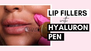 No Needle Lip Filler With Hyaluron Pen  Procedure And Aftercare Ft SaigeWellington [upl. by Johnathan]