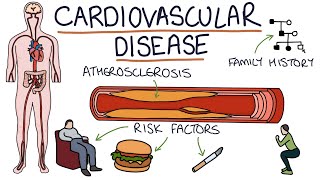 Understanding Cardiovascular Disease Visual Explanation for Students [upl. by Elcin]