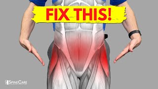 How to Fix Pelvic Pain FOR GOOD [upl. by Aleuqahs833]