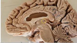 Diencephalon Anatomy [upl. by Ky]