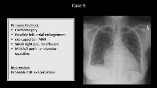 How to Interpret a Chest XRay Lesson 10  Self Assessment Part 1 [upl. by Rengia199]