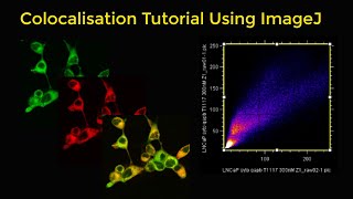 Colocalisation tutorial using ImageJ [upl. by Baseler]