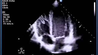 Understanding Echo Standard Imaging Views [upl. by Bocaj]