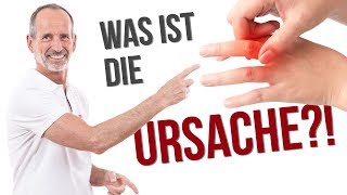 Darum hast du einen Schnappfinger – Ursachen verständlich erklärt ✅ [upl. by Airretnahs]