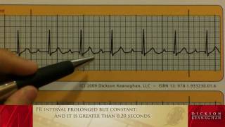 EKG Training An Introduction to Bradycardia  Heart Blocks Part 1 of 3 [upl. by Rachaba830]