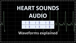 Normal Heart Sounds  Auscultation  Audio [upl. by Kaleena245]