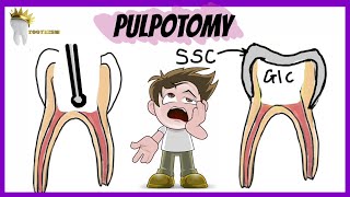 PEDIATRIC DENTISTRY  PULPOTOMY  Types Indications Procedure [upl. by Ivgnout]