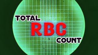 Red Blood Cell Count Test  Total RBC count  Procedure and Calculations [upl. by Garwin76]