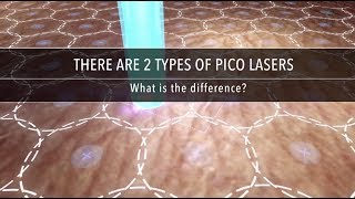 Why Are There Different Types of Pico Laser  Dr Kenneth Thean [upl. by Epolenep]