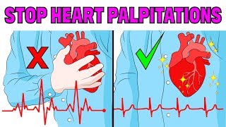 What causes heart palpitations or a heart flutter [upl. by Annawit]