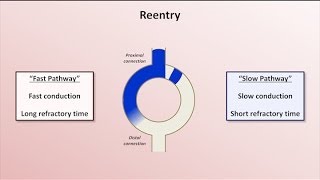 Intro to EKG Interpretation  Mechanisms of Tachyarrhythmias [upl. by Arymas]