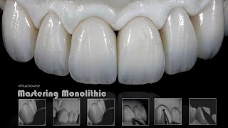 Mastering Monolithic Zirconia IN ENGLISH [upl. by Faustine]