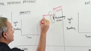 Basic Vent Modes MADE EASY  Ventilator Settings Reviewed [upl. by Ennairod]