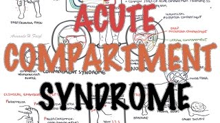 Compartment Syndrome  Overview signs and symptoms pathophysiology treatment [upl. by Foy]