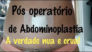 Pós operatório de Abdominoplastia lipoaspiração e enxerto de glúteo  dicas [upl. by Lillywhite]