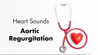 Aortic Regurgitation  Heart Sounds  MEDZCOOL [upl. by Rehtnug]