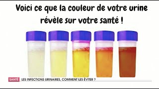 COMMENT TRAITER LES INFECTIONS URINAIRES [upl. by Tyika]