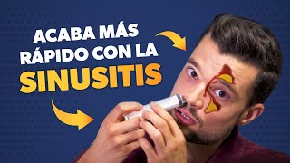 Cómo curar la SINUSITIS más rápido [upl. by Etna]