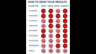 blood group all ab abooabab How to blood Grouping [upl. by Fantasia]