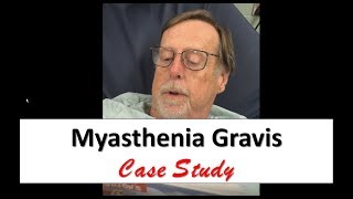 What Is Myasthenia Gravis [upl. by Rednaskela]