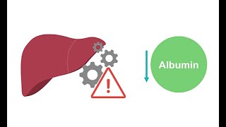 Getting to know albumin physiology [upl. by Harwill324]