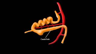 Bakers Cyst  Everything You Need To Know  Dr Nabil Ebraheim [upl. by Eberto]