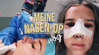 Meine Nasen OP Vlog Hannah [upl. by Justina]