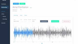 Eko Digital Stethoscope  Atrial Fibrillation [upl. by Lynde906]