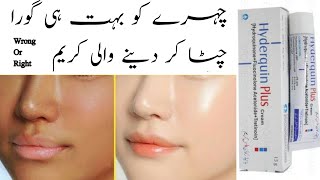 Hydroquinone plus cream effects must watch and save your skinAnmol beauty tips [upl. by Chee199]