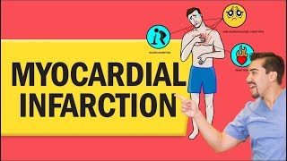 Myocardial Infarction Heart Attack for Nursing amp NCLEX [upl. by Dnalram639]