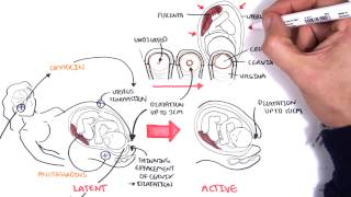 Obstetrics  Stages of Labour [upl. by Aniratak272]