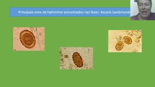 Técnicas laboratoriais II Aula 10 Atlas parasitológico Vídeo aula [upl. by Dweck]