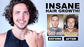 ✅ Awkward Stage Inspiration  INSANE Hair Growth Time Lapses [upl. by Vida]